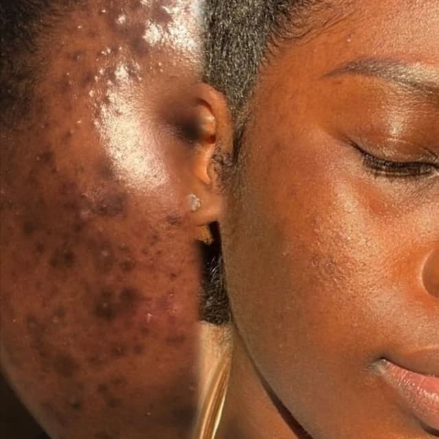 Clear Skin Club at EsthiLuxe Studio in Woodbridge, VA